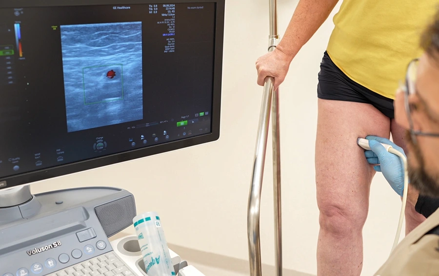 Doppler USG żył