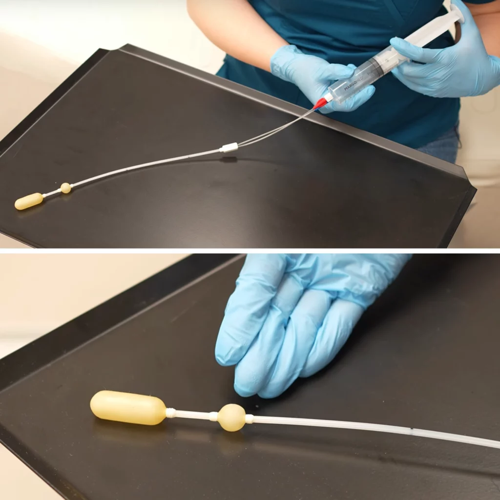 Rehabilitacja anorektalna
