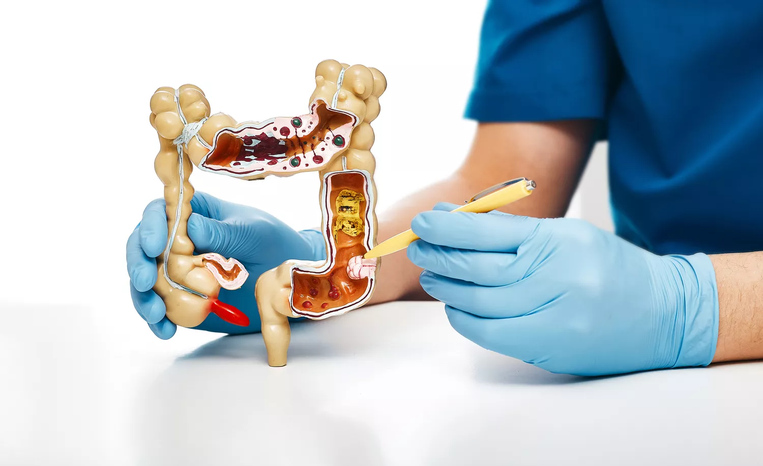 Choroby Jelita Gdańsk - Alfa Clinic Centrum Medyczne (Gastroenterologia)