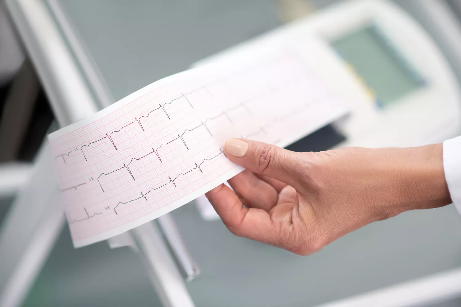 EKG Serca Gdańsk - Alfa Clinic Centrum Medyczne (Kardiologia)