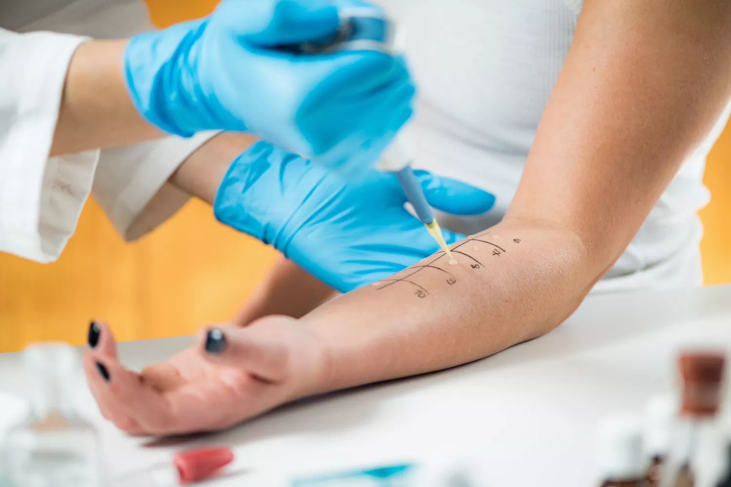 Leczenie Alergii Gdańsk - Alfa Clinic Centrum Medyczne (Alergologia)