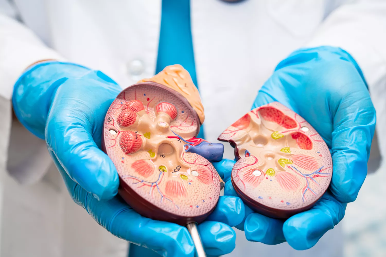 Leczenie kamicy nerkowej Gdańsk - Alfa Clinic Centrum Medyczne (Urologia)