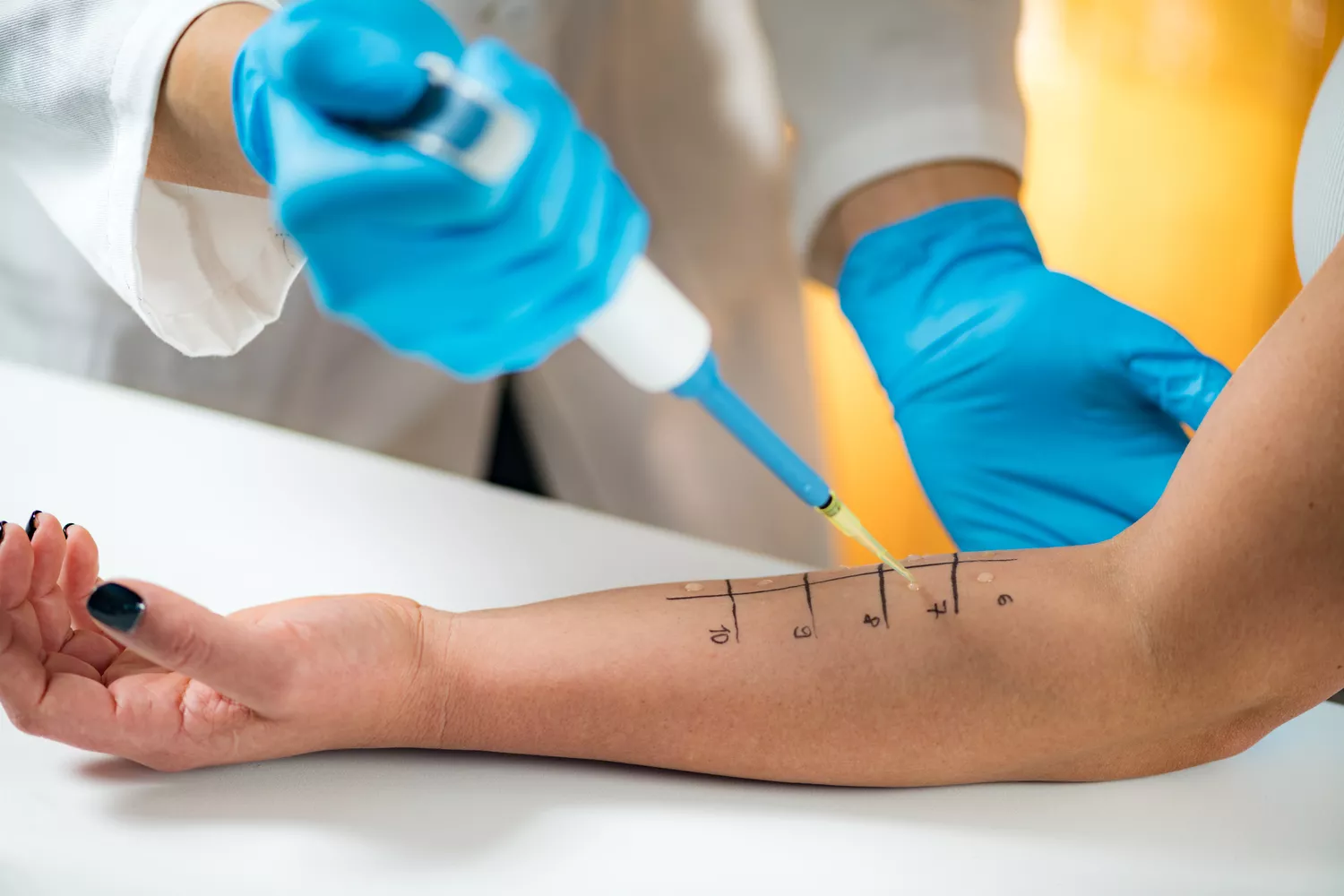 Odczulanie Gdańsk - Alfa Clinic Centrum Medyczne (Alergologia)