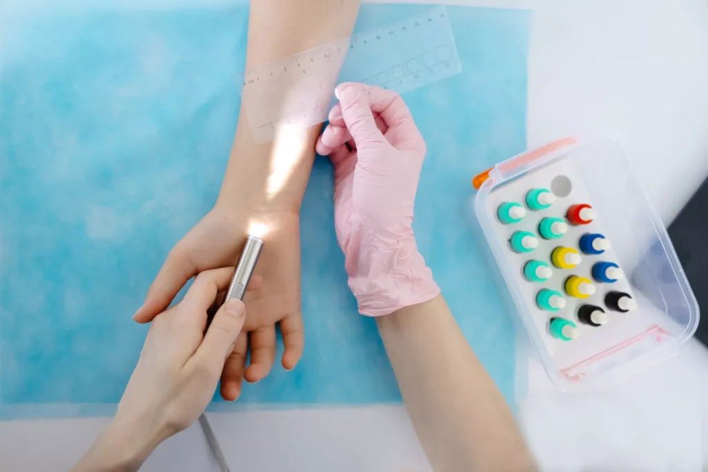 Testy Alergiczne Gdańsk - Alfa Clinic Centrum Medyczne (Alergologia)