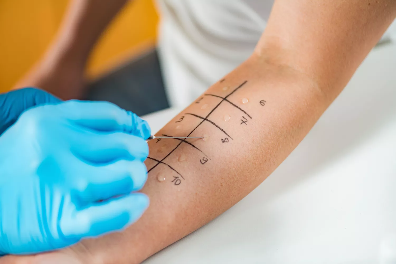 Testy Alergiczne Gdańsk - Alfa Clinic Centrum Medyczne (Alergologia)