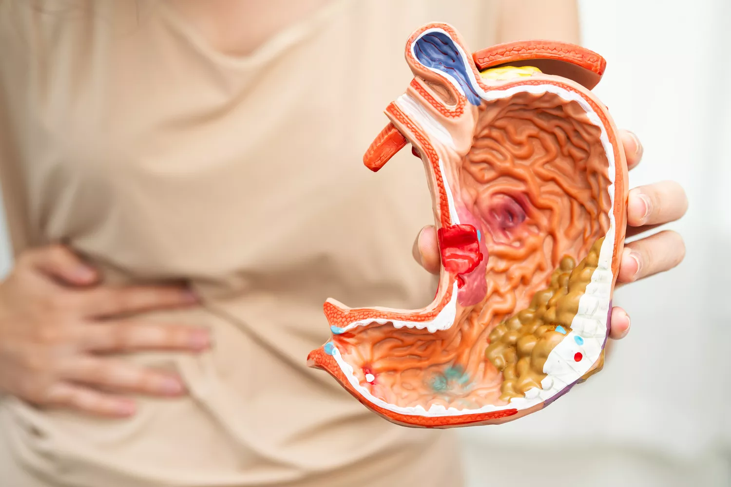 Leczenie choroby wrzodowej Gdańsk - Alfa Clinic Centrum Medyczne (Gastroenterologia)