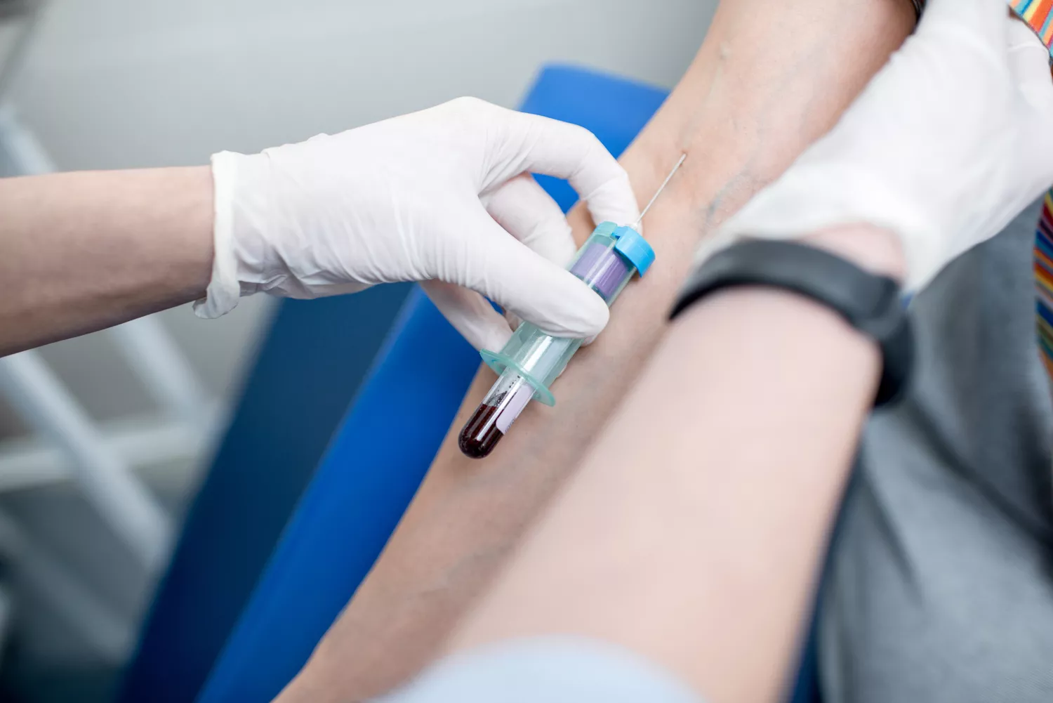 Leczenie hiperprolaktynemii Gdańsk - Alfa Clinic Centrum Medyczne (Ginekologia)