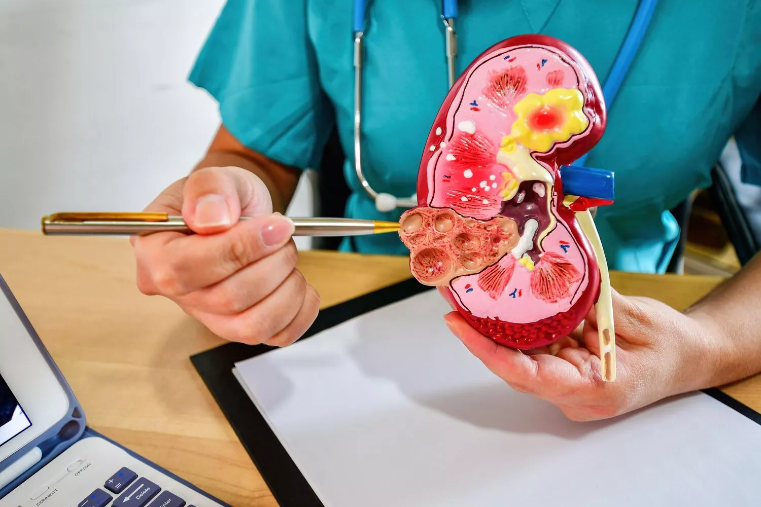 Leczenie wodonercza Gdańsk - Alfa Clinic Centrum Medyczne (Urologia)