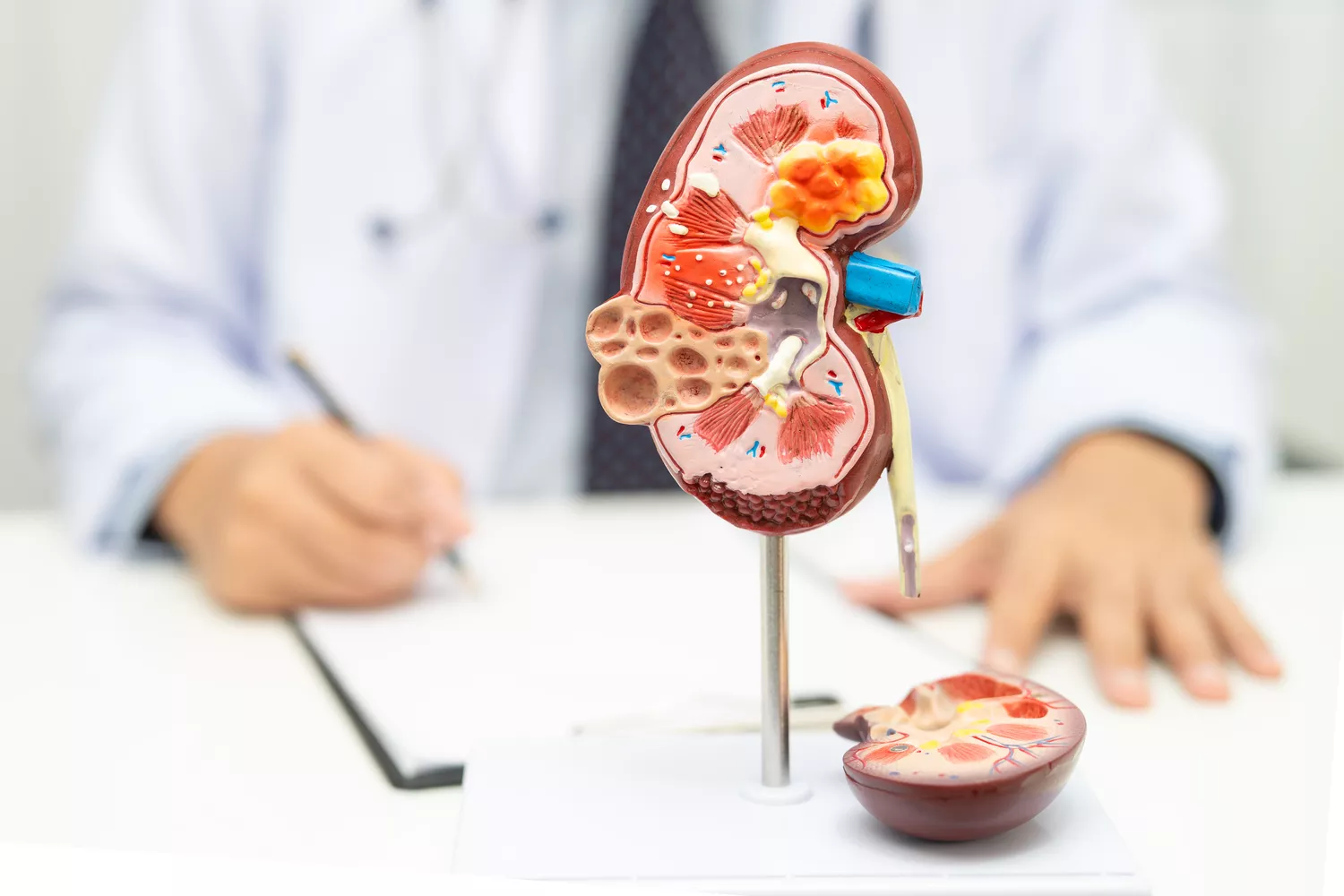 Leczenie wodonercza Gdańsk - Alfa Clinic Centrum Medyczne (Urologia)