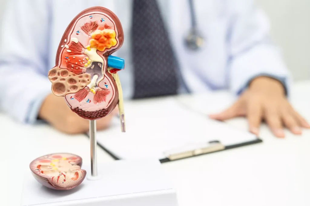 Terapia kolki nerkowej Gdańsk - Alfa Clinic Centrum Medyczne (Urologia)