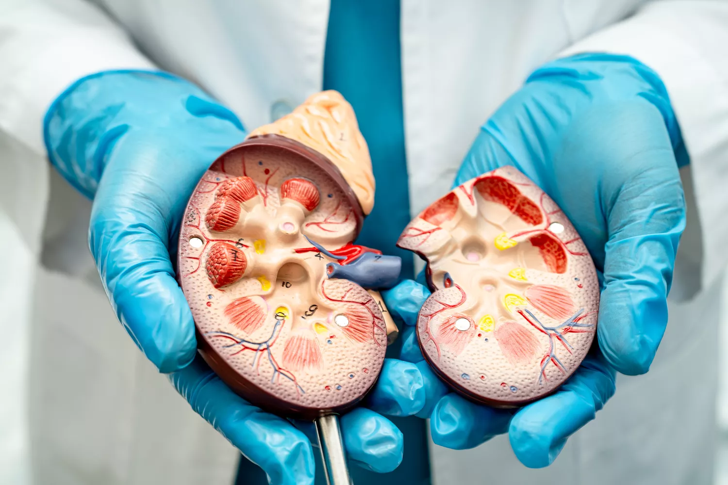 Terapia kolki nerkowej Gdańsk - Alfa Clinic Centrum Medyczne (Urologia)